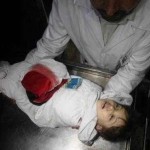 طبيب في مستشفى الشفاء دعي لمعاينة طفل شهيد